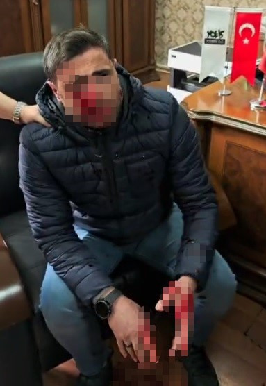 Trabzon’da skandal olay! Veli, okulda öğretmeni darp etti