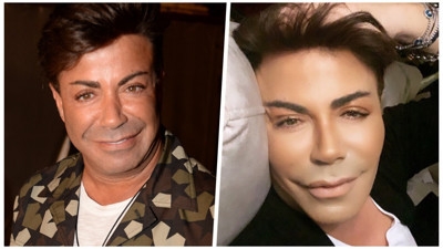 Yoğun bakımda yaşam mücadelesi veren Fatih Ürek'le ilgili üzen gelişme!