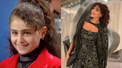 Azeri şarkıcı Günel Zeynalova'dan estetik çıkışı! İddialar isyan ettirdi