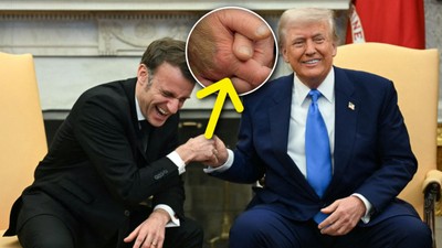 Trump'ın eline ne oldu? Gizemli morluk dikkat çekti! Macron ile tokalaşmasında ilginç detay...