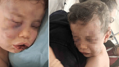2 yaşındaki çocuğa vahşeti yaşattılar! Masum çocuk yoğun bakımda, anne ile sevgilisi gözaltında...