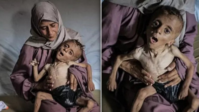 Bu bir fotoğraf değil, feryat! Gazze'de açlıktan ölmek üzere olan Muhammed bebeğin çığlığına dünya sağır!