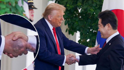 Donald Trump'ın elindeki gizemli morluk tekrar ortaya çıktı!