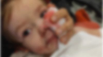 Pitbull cinsi köpeğin saldırısına uğrayan çocuğun yüzü paramparça oldu