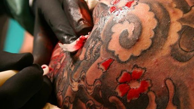 Dövme yaptırdı, ölümcül leptospiroz hastalığından hayatını kaybetti