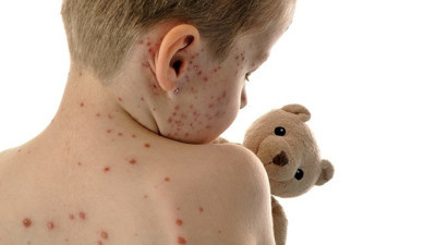 Kritik açıklama: 2 yeni hasta daha tespit edildi