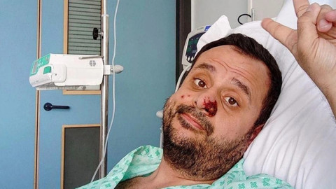 Maymun çiçeğine yakalanan Türk hasta yaşadıklarını anlattı: Derim kemiklerimden çekiliyor gibi hissettim!