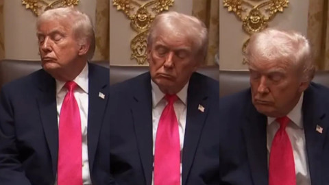 Şişlik, morluk, uyuklama… Trump’ın sağlığında neler oluyor?