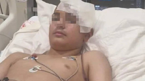 Akran şiddeti komaya soktu! 13 yaşındaki çocuğun kafatası titanyumla yeniden yapıldı