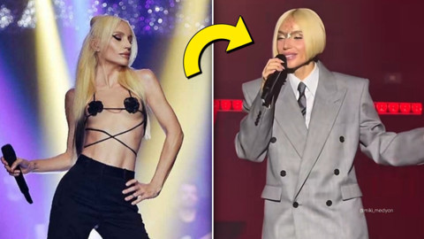 Gülşen'i hiç böyle görmediniz... Peş peşe operasyonlar sonrası sahne tarzındaki değişim dikkat çekti! Tesadüf mü yoksa mesaj mı?