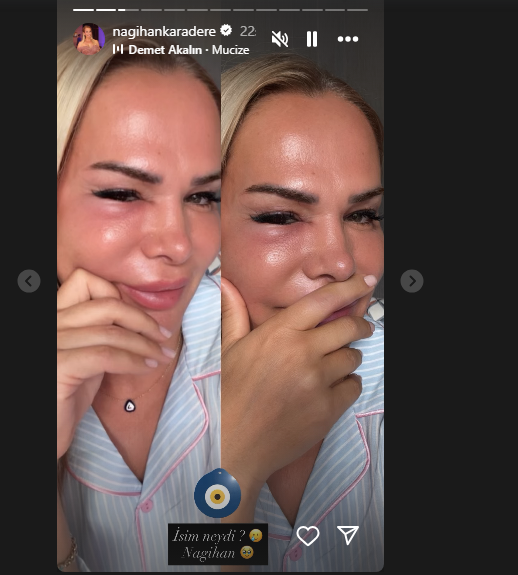 Nagihan Karadere'nin yüzüne ne oldu? Kavgaya karıştı iddiası