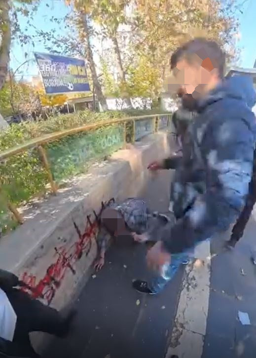 Sosyal medyada tuzak kurdu! Yengesini taciz eden adamı buluşmaya çağırıp bacaklarından vurdu