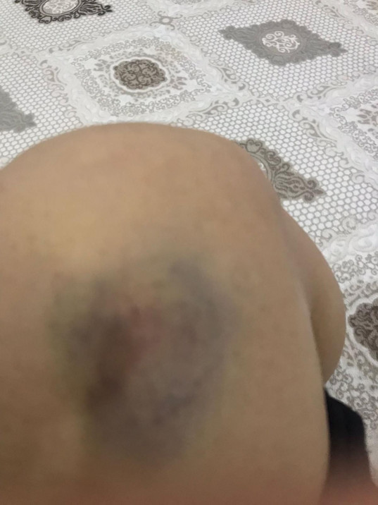 Sporda şiddet kadınlara sıçradı: Bingöl’de yaşanan arbedeyi kameralar ortaya çıkaracak! - Resim : 9