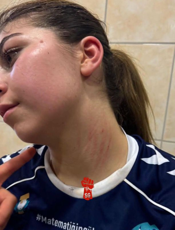 Sporda şiddet kadınlara sıçradı: Bingöl’de yaşanan arbedeyi kameralar ortaya çıkaracak! - Resim : 8