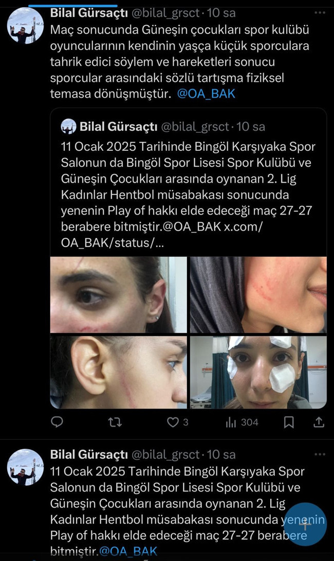 Sporda şiddet kadınlara sıçradı: Bingöl’de yaşanan arbedeyi kameralar ortaya çıkaracak! - Resim : 4