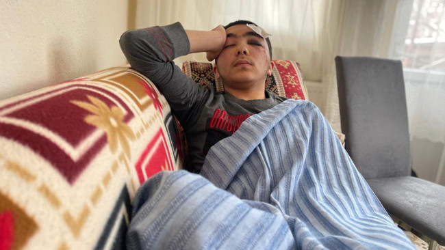 Başıboş köpek terörü! 16 yaşındaki hafız Salih Yıldırım ölümden döndü... Kafatası çatladı!