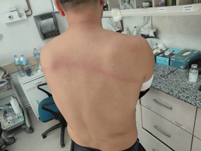 CHP’li başkan zabıtaları parke taşı döşemeye zorladı: Reddedenlerin sırtında sopa kırdı! - Resim : 3