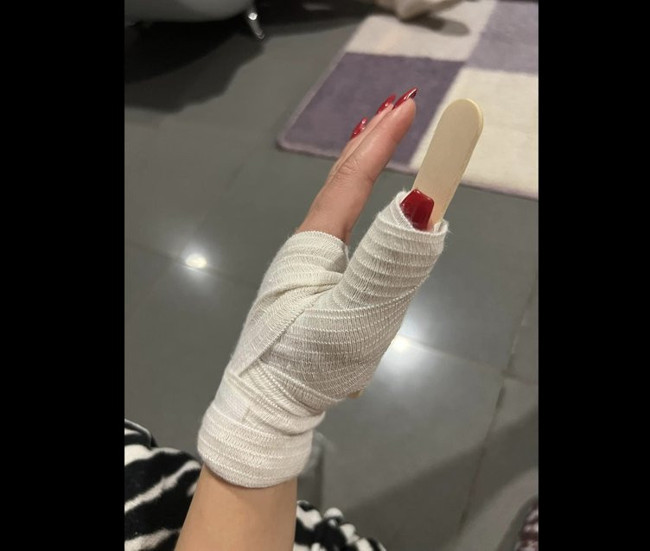 Kıbrıs Türkü Asya Karaali’ye 3 Rum erkekten ırkçı saldırı! Parmaklarını kırıp duvardan attılar - Resim : 3