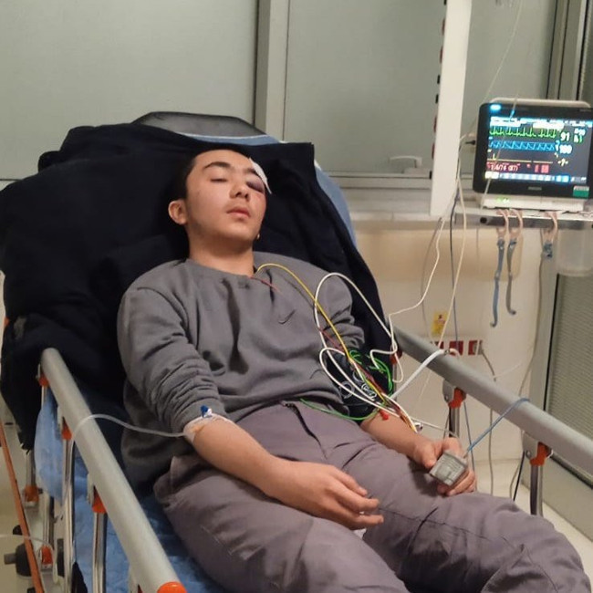 Başıboş köpek terörü! 16 yaşındaki hafız Salih Yıldırım ölümden döndü... Kafatası çatladı! - Resim : 4