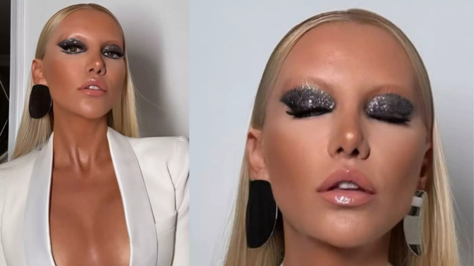 Gülşah Saraçoğlu'nun 9 saatlik estetik operasyonu gündem oldu: Tanınmaz hale geldi! 'Resmen yüz nakli'