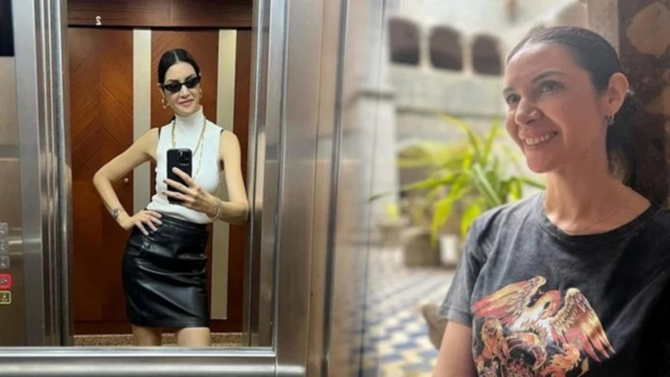 Beyin anevrizması teşhisi konmuştu! Ahu Yağtu son halini paylaştı - Resim : 2