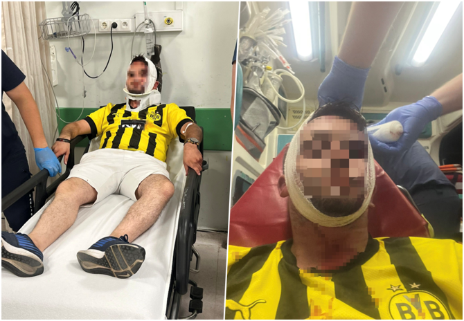 Daire satışında kriz! Kaporasını geri isteyince ortalık savaş alanına döndü! Tekme ve sopalar havada uçuştu - Resim : 2