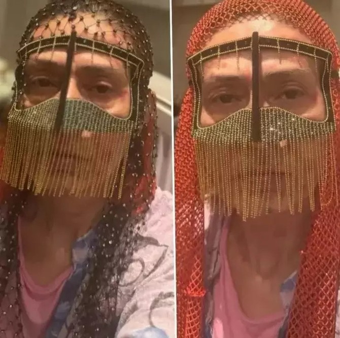 Saç boyası nedeniyle yüzünde kimyasal yanıklar oluşan Yıldız Tilbe çareyi maske takmakta buldu