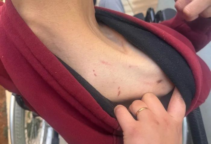 Gaziantep’te vicdanları yaralayan iddia! Engelli bakım merkezinde ne oldu? 28 yaşındaki genç darp edildi, 6 dikiş atıldı... - Fotoğraf: 3