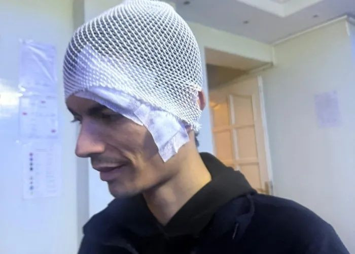 Gaziantep’te vicdanları yaralayan iddia! Engelli bakım merkezinde ne oldu? 28 yaşındaki genç darp edildi, 6 dikiş atıldı... - Fotoğraf: 2