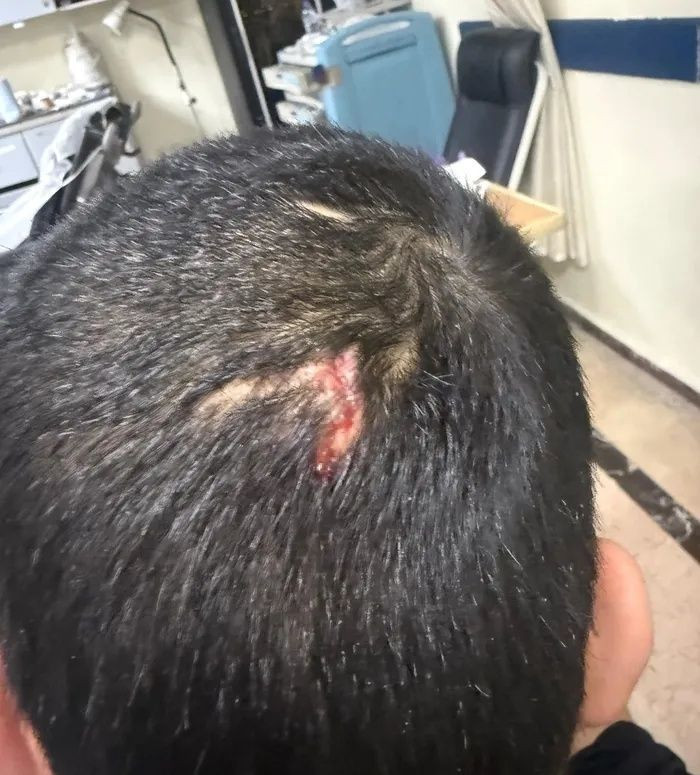 Gaziantep’te vicdanları yaralayan iddia! Engelli bakım merkezinde ne oldu? 28 yaşındaki genç darp edildi, 6 dikiş atıldı... - Fotoğraf: 4