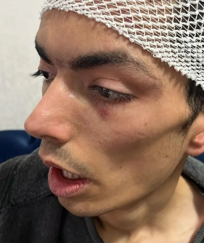 Gaziantep’te vicdanları yaralayan iddia! Engelli bakım merkezinde ne oldu? 28 yaşındaki genç darp edildi, 6 dikiş atıldı... - Fotoğraf: 5