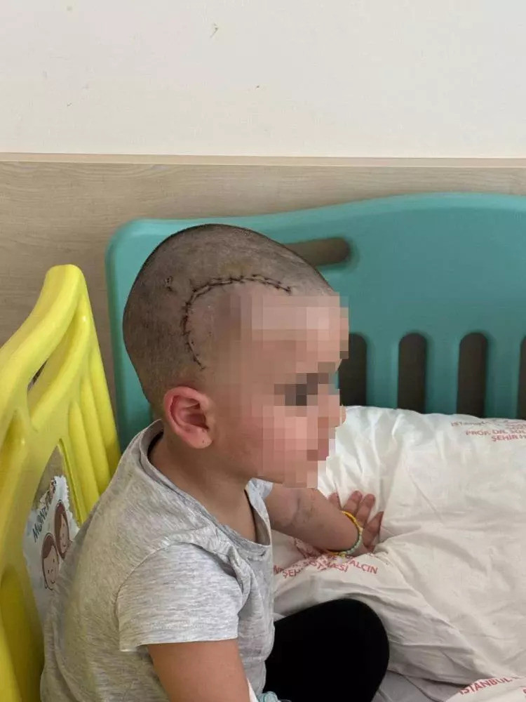 Anaokulunda korkunç kaza: Küçük çocuk ölümün kıyısında döndü - Resim : 3