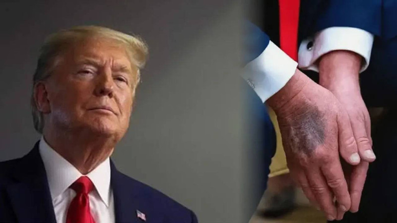 ABD Başkanı Trump bizzat kendisi açıkladı: Sağlık taramasına girdi