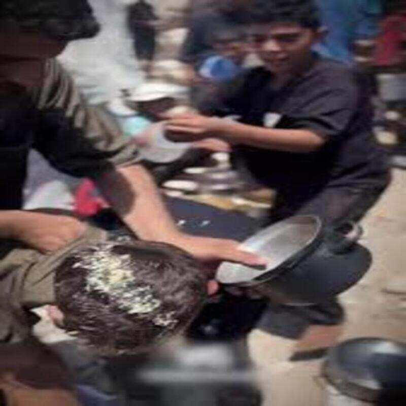 Yürek yakan anlar... Gazze'de ailesine yemek götürmek isteyen çocuk yandı