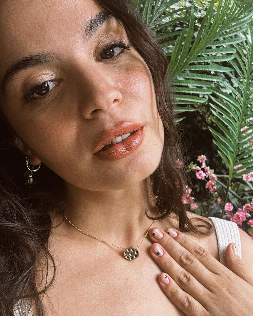 Doktorlar yanlışlıkla bağırsağını kesmişti! Aslı Bekiroğlu hastane odasından son halini paylaştı - Fotoğraf: 7