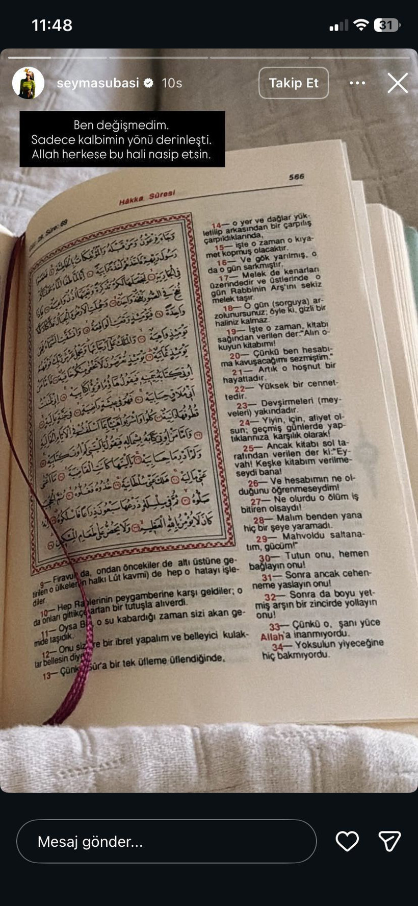 Şeyma Subaşı sessizliğini bozdu! Türkiye’ye dönüş tarihini açıkladı: “Süreçten kaçmıyorum, teslimiyetle karşılıyorum” - Fotoğraf: 2