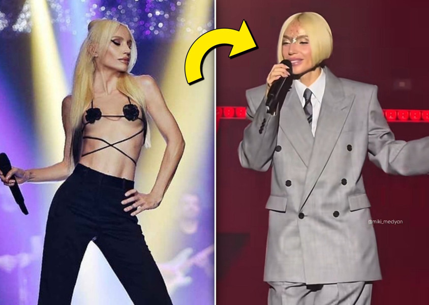 Gülşen'i hiç böyle görmediniz... Peş peşe operasyonlar sonrası sahne tarzındaki değişim dikkat çekti! Tesadüf mü yoksa mesaj mı?