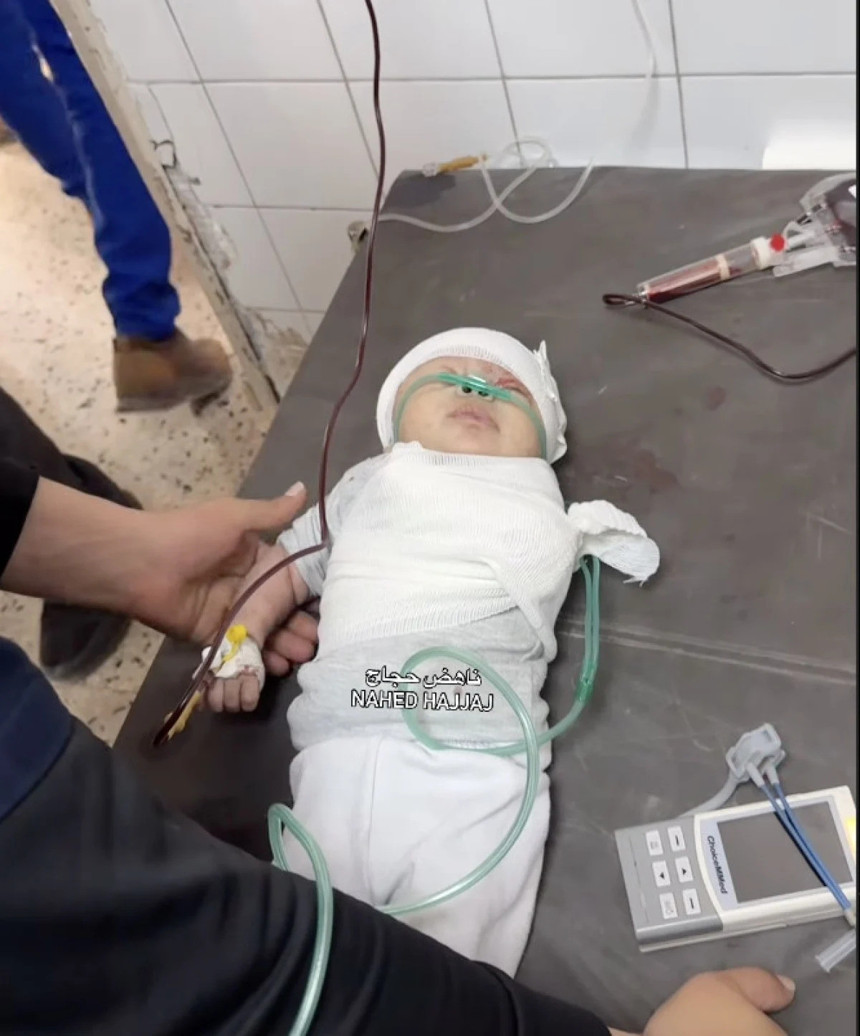 Bebek Katili İsrail! Saldırıda kolu kopan Gazzeli minik bebeğin son hali yürekleri burktu!