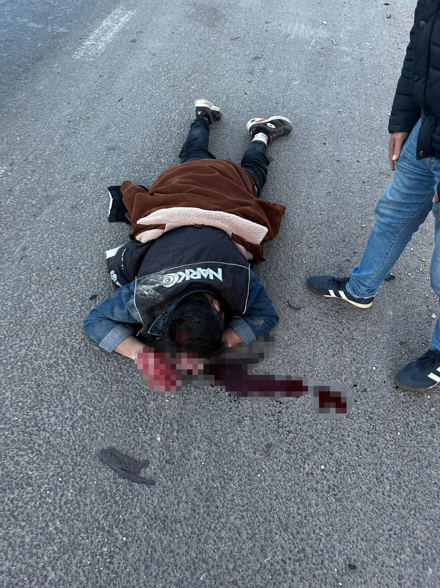 Mardin’de skandal kaçış: Polise çarpıp kaçan sürücü kamerada, memur ağır yaralı