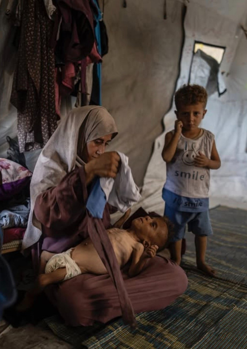 Gazze'de açlıktan ölümler durdurulamıyor! Katil İsrail'in ablukası nedeniyle son 24 saatte 9 Filistinli daha can verdi