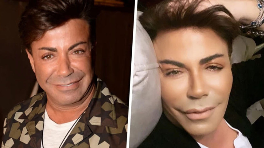 Fatih Ürek bitkisel hayata mı girdi? Canlı yayında kahreden iddia