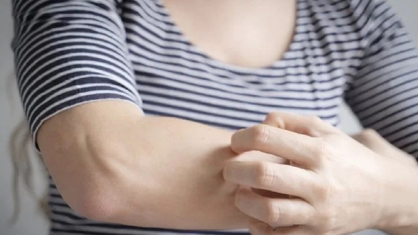 Cilt kaşıntısının nedeni ortaya çıktı! Meğer kaşınmak vücutta bambaşka etkilere sahipmiş