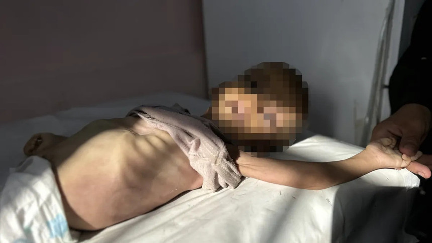 Gazze'de soykırım var! 11 kişi açlıktan hayatını kaybetti