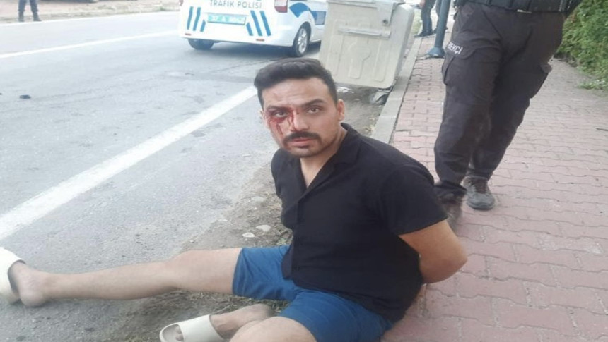 Bartın'da eşinden şiddet gören kadının yardım çığlığı: Beni öldürmesini mi bekliyorlar? - Resim : 2