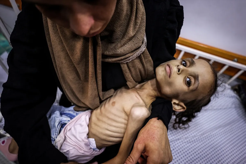 Gazze'de açlıktan ölenlerin sayısı gün geçtikçe artıyor