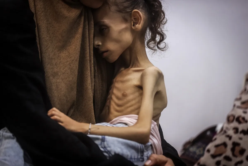 Gazze'de açlıktan ölenlerin sayısı gün geçtikçe artıyor - Resim : 2