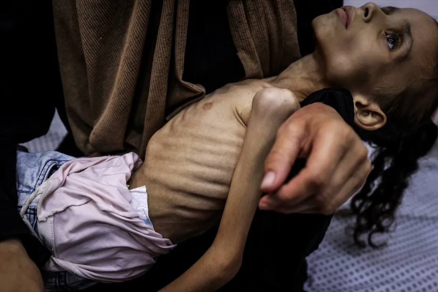 Gazze'de açlıktan ölenlerin sayısı gün geçtikçe artıyor - Resim : 3