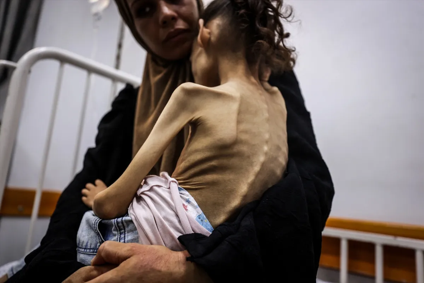 Gazze'de açlıktan ölenlerin sayısı gün geçtikçe artıyor - Resim : 4