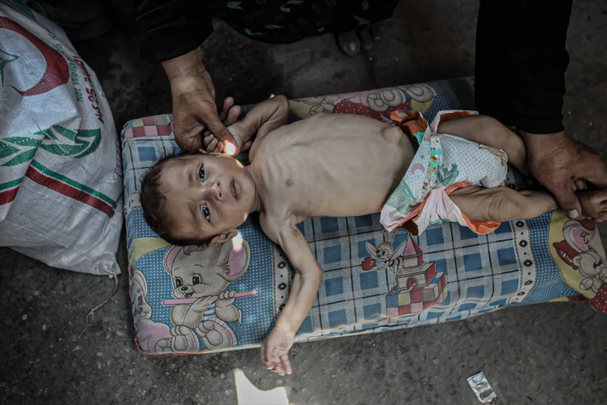 Gazze'de açlıktan ölenlerin sayısı gün geçtikçe artıyor - Resim : 5