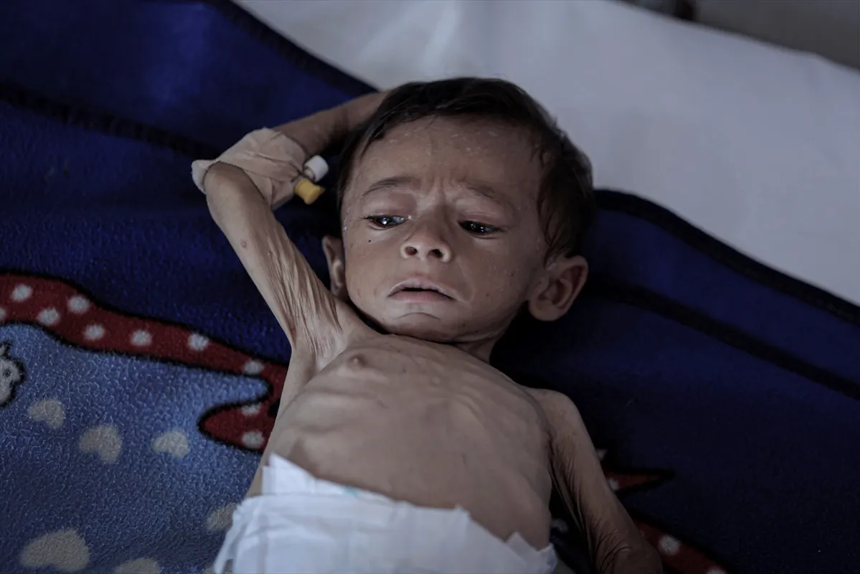 Gazze'de açlıktan ölenlerin sayısı gün geçtikçe artıyor - Resim : 7